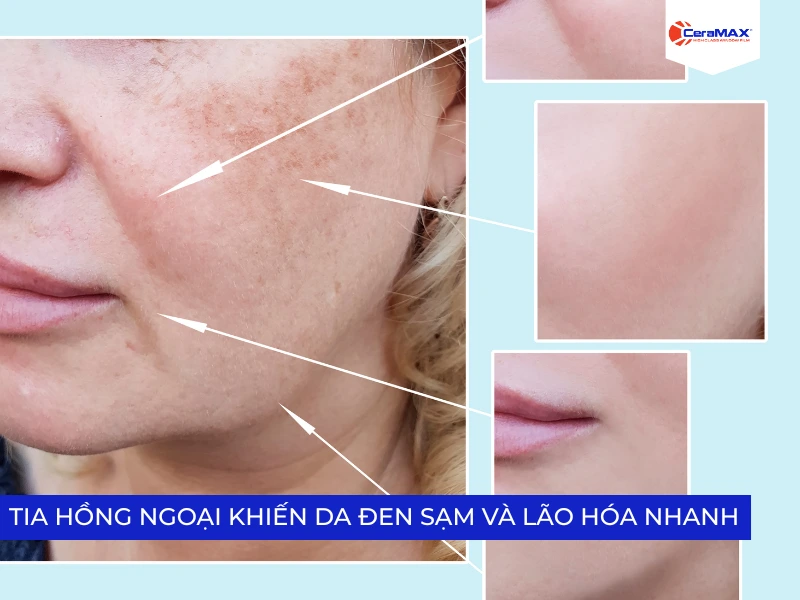 Tác hại của tia hồng ngoại